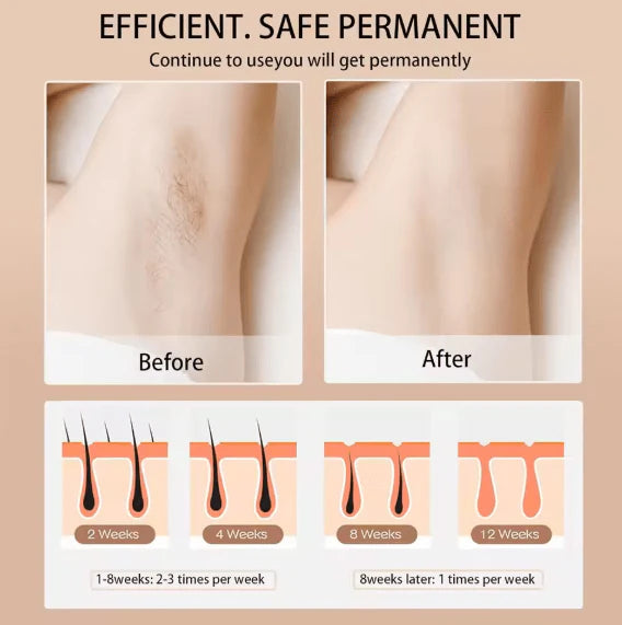 IPL Hair Removal Device – 3 Modes Full Body At Home