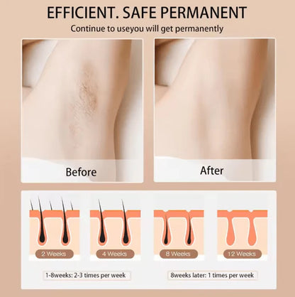 IPL Hair Removal Device – 3 Modes Full Body At Home