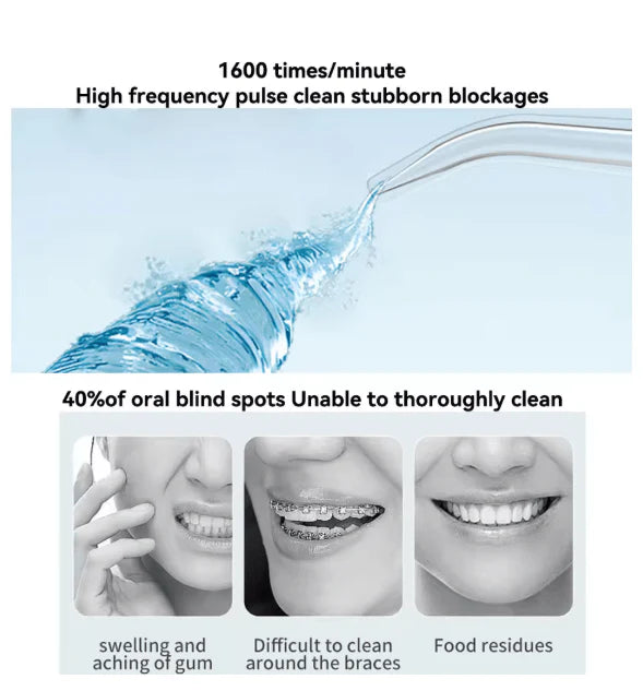 Oral Irrigator Water Flosser – 3 Modes Cordless